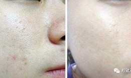 吃鸡皮肤爆料最新车皮肤,吃鸡游戏带你领略速度与激情